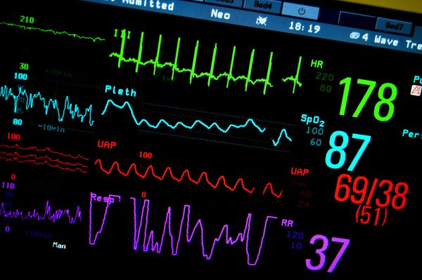 Monitoring in Azure